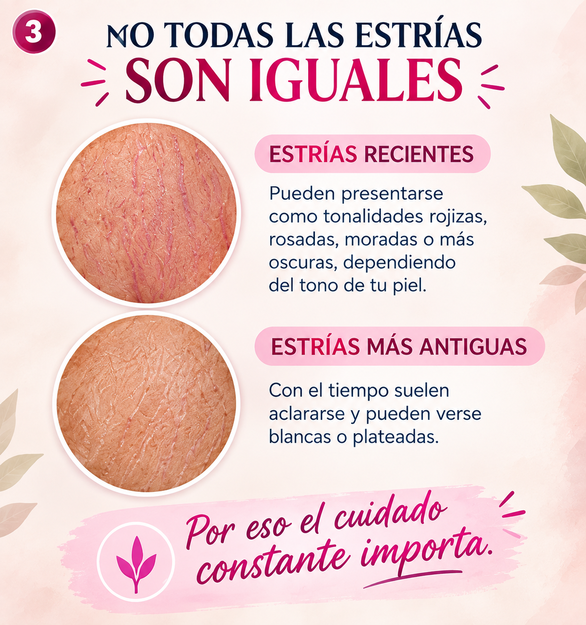 ADIOS ESTRIAS (crema de cuidado corporal)